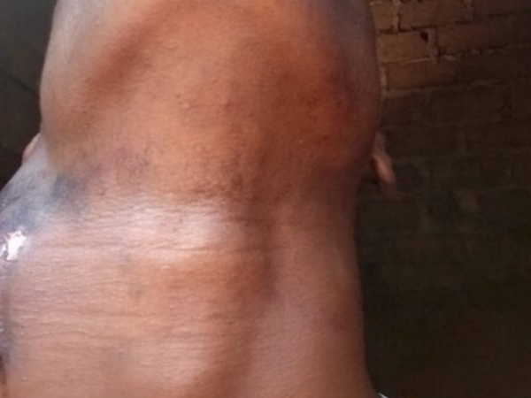 SOUTENIR MEKADOR : aidons Mekador a finalisé son opération du cou