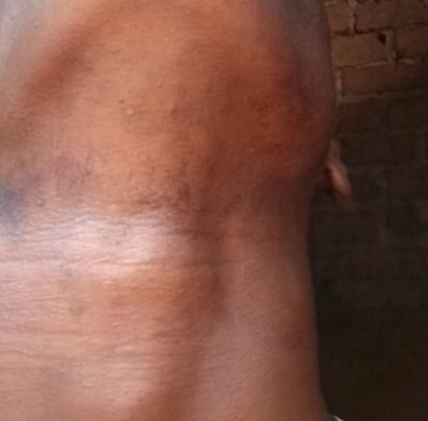 SOUTENIR MEKADOR : aidons Mekador a finalisé son opération du cou